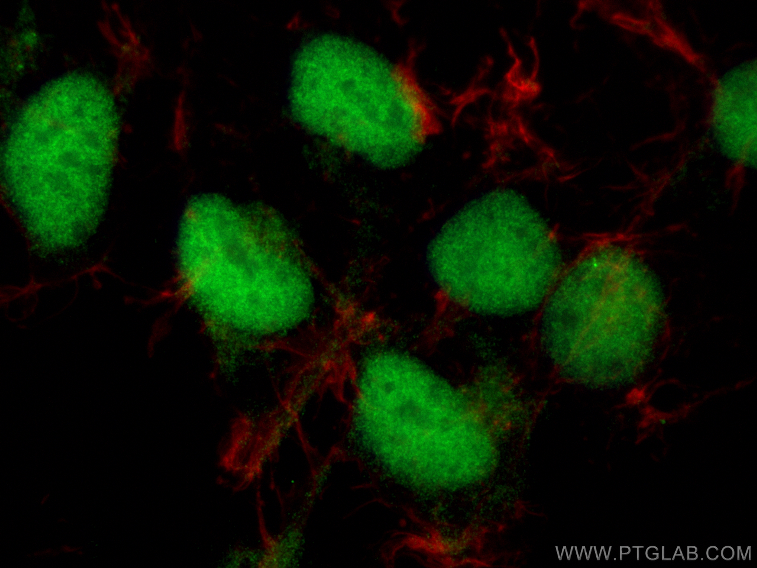 Immunofluorescence (IF) / fluorescent staining of HEK-293 cells using C5orf24 Polyclonal antibody (24319-1-AP)