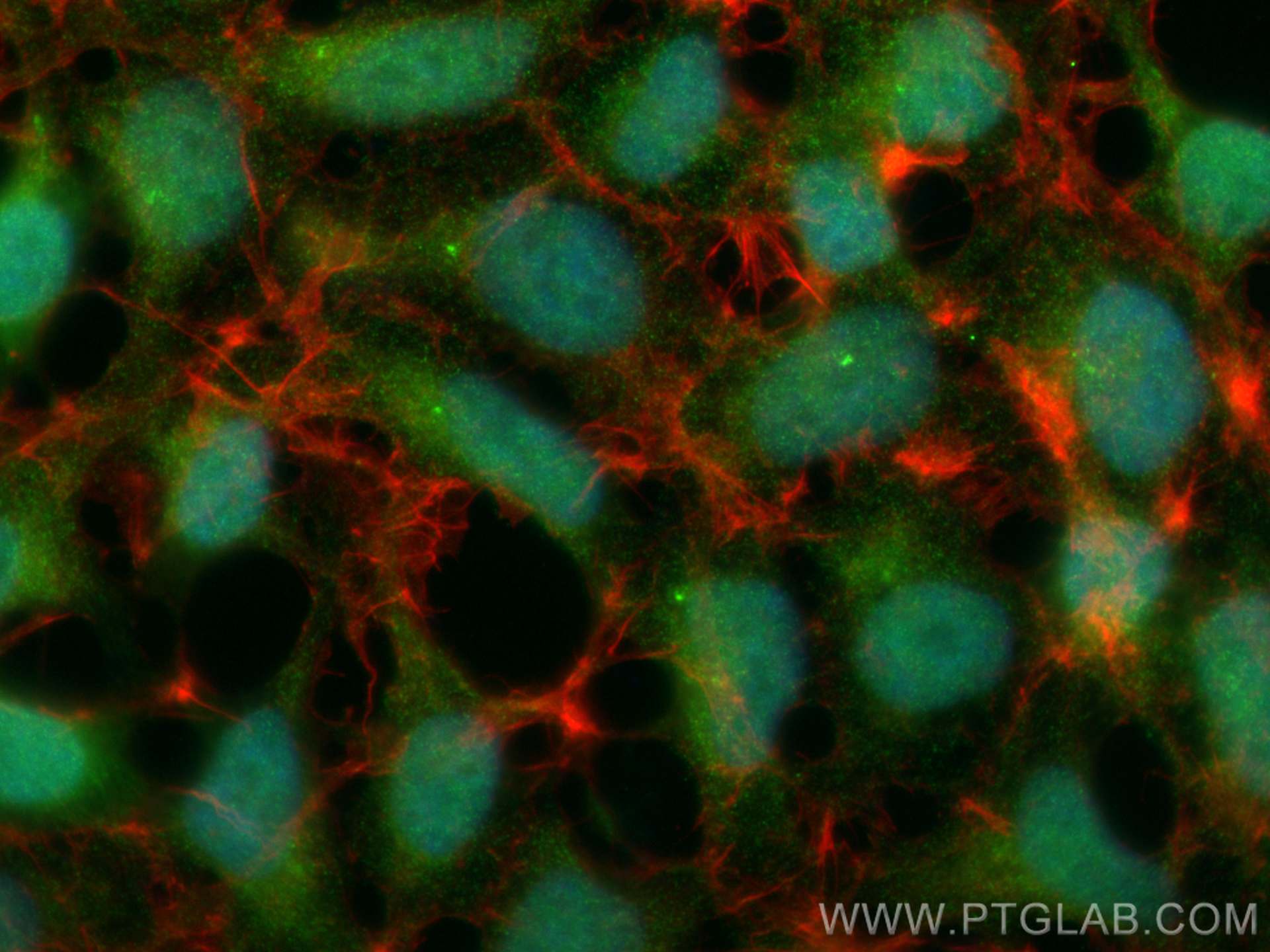 Immunofluorescence (IF) / fluorescent staining of HEK-293 cells using C6orf108 Monoclonal antibody (68310-1-Ig)