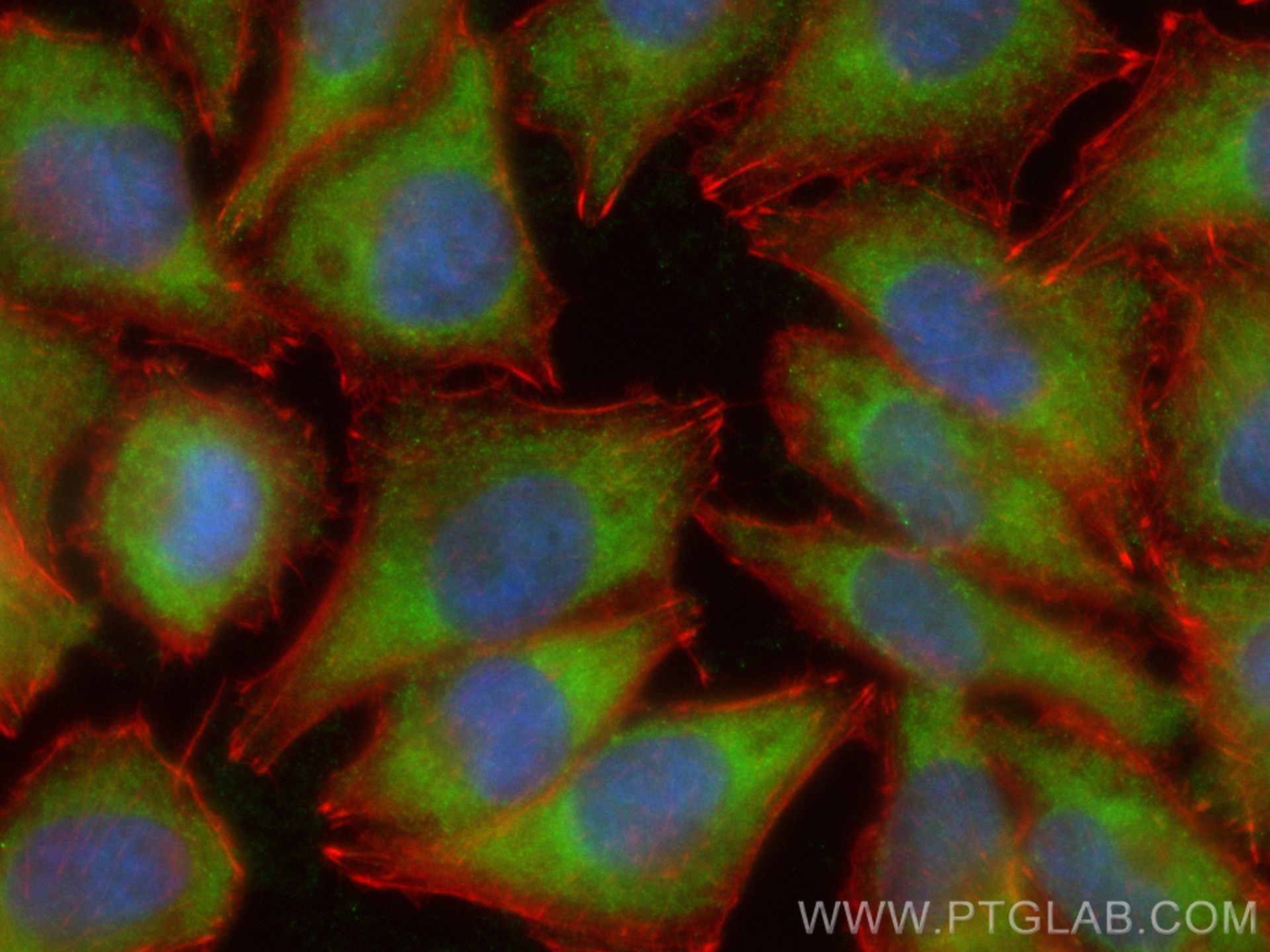 Immunofluorescence (IF) / fluorescent staining of A375 cells using CoraLite® Plus 488-conjugated C6orf15 Polyclonal a (CL488-24953)