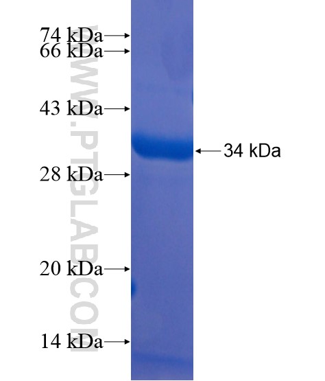 C6orf185 fusion protein Ag21675 SDS-PAGE