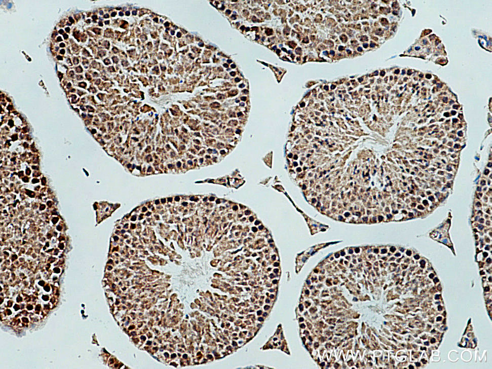 Immunohistochemistry (IHC) staining of mouse testis tissue using CEP85L Polyclonal antibody (24588-1-AP)