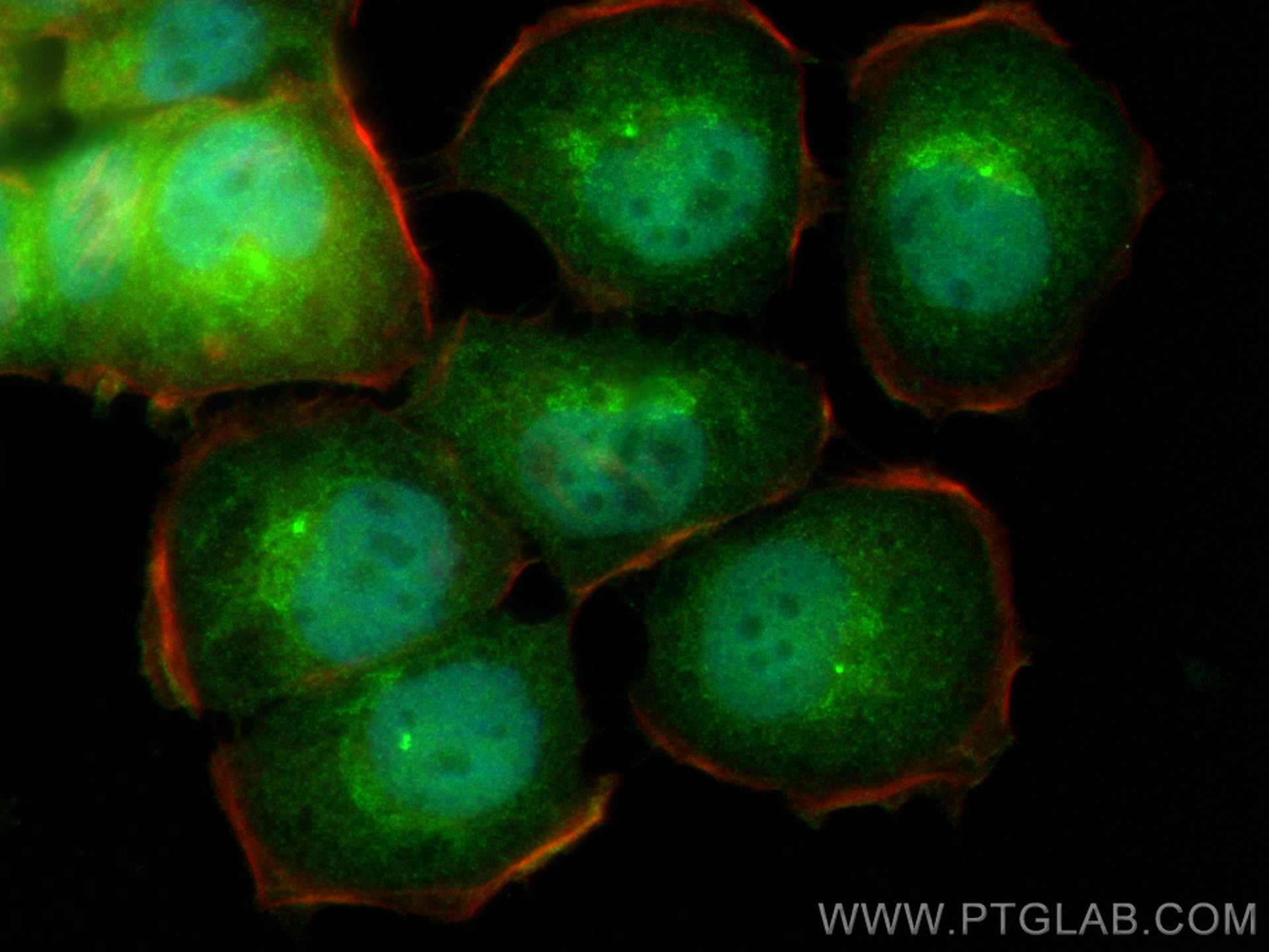 Immunofluorescence (IF) / fluorescent staining of T-47D cells using C6orf211/ARMT1 Polyclonal antibody (25124-1-AP)