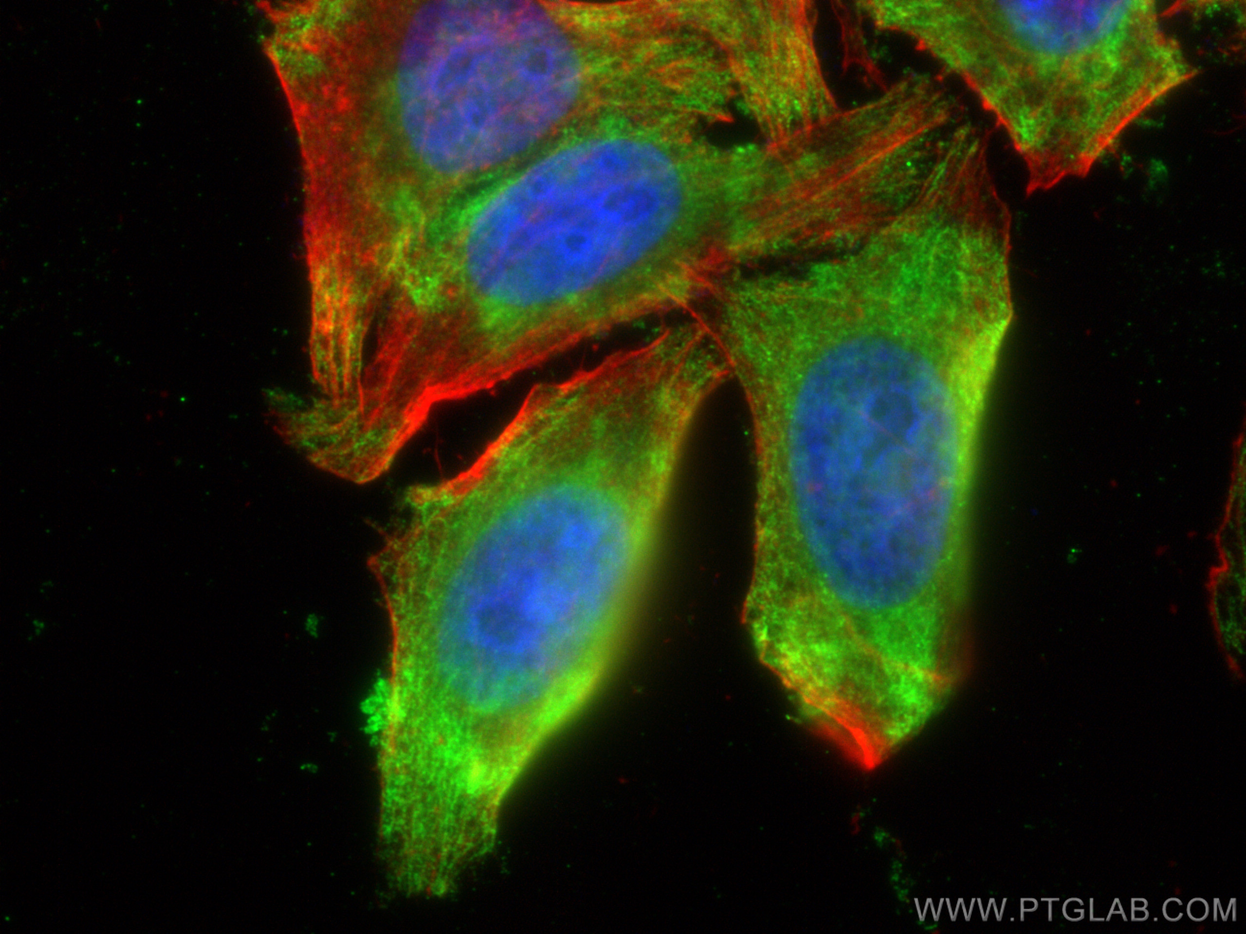 Immunofluorescence (IF) / fluorescent staining of HepG2 cells using C7 Monoclonal antibody (66908-1-Ig)