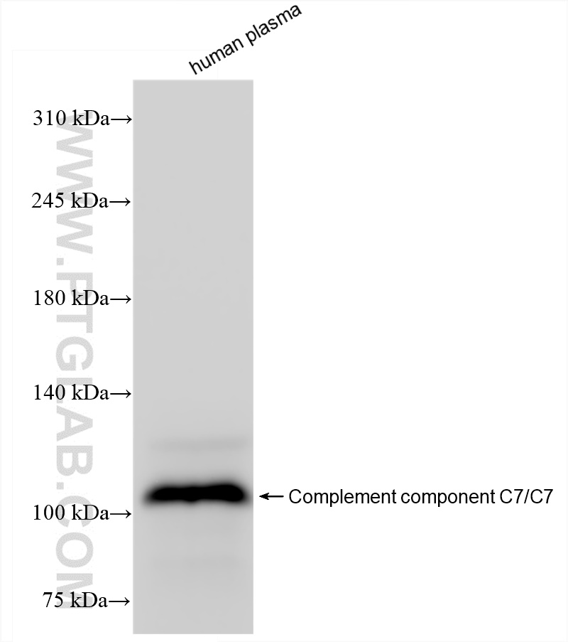 Western Blot (WB) analysis of human plasma using C7 Recombinant antibody (84263-5-RR)