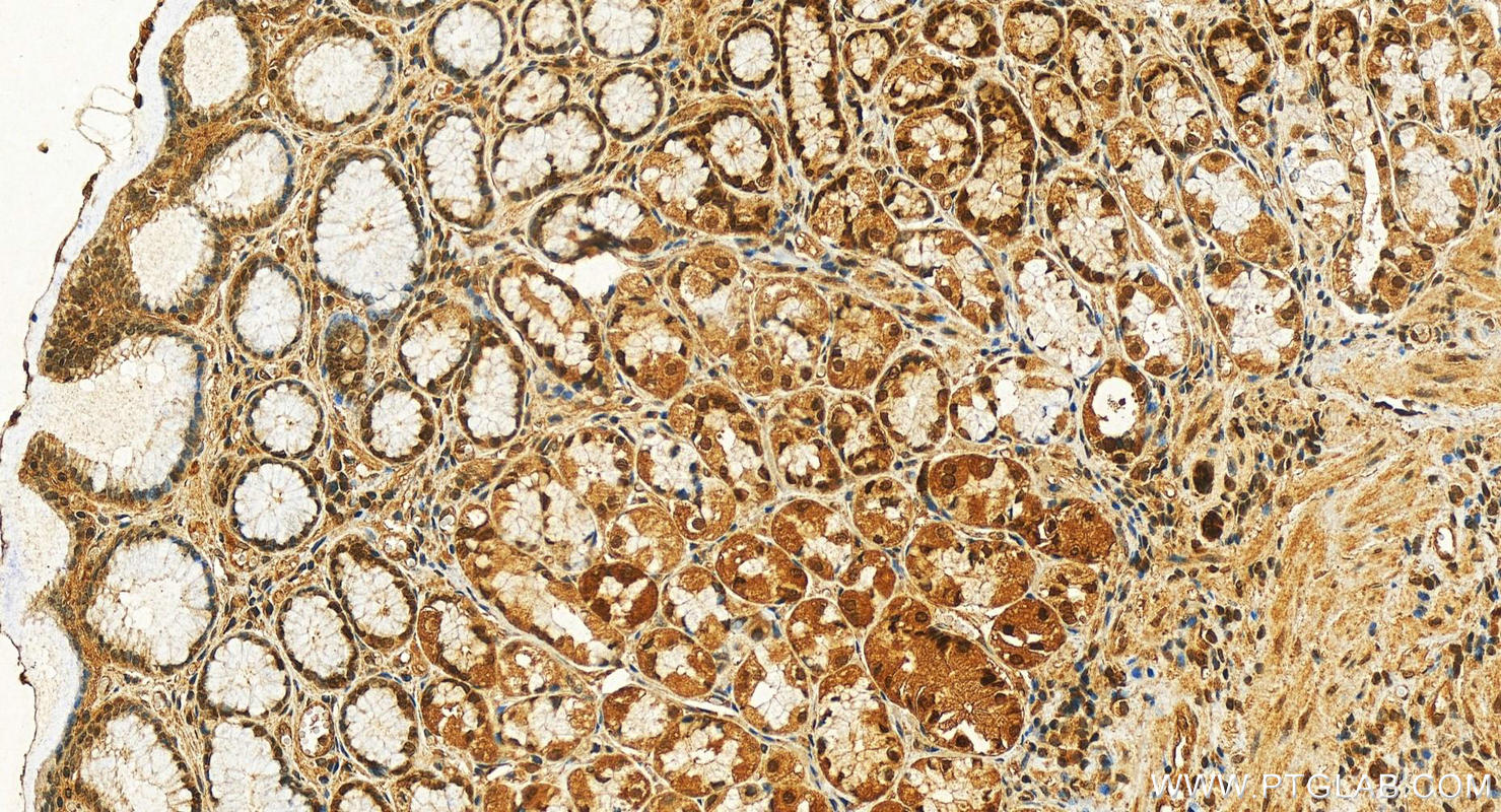 Immunohistochemistry (IHC) staining of human stomach tissue using C7orf50 Polyclonal antibody (20797-1-AP)