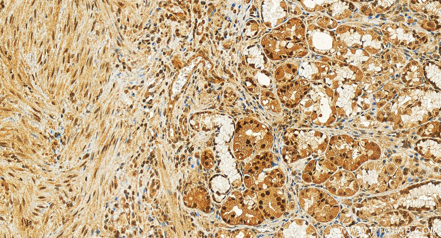 Immunohistochemistry (IHC) staining of human stomach tissue using C7orf50 Polyclonal antibody (20797-1-AP)