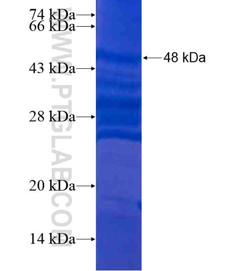 C7orf63 fusion protein Ag21205 SDS-PAGE