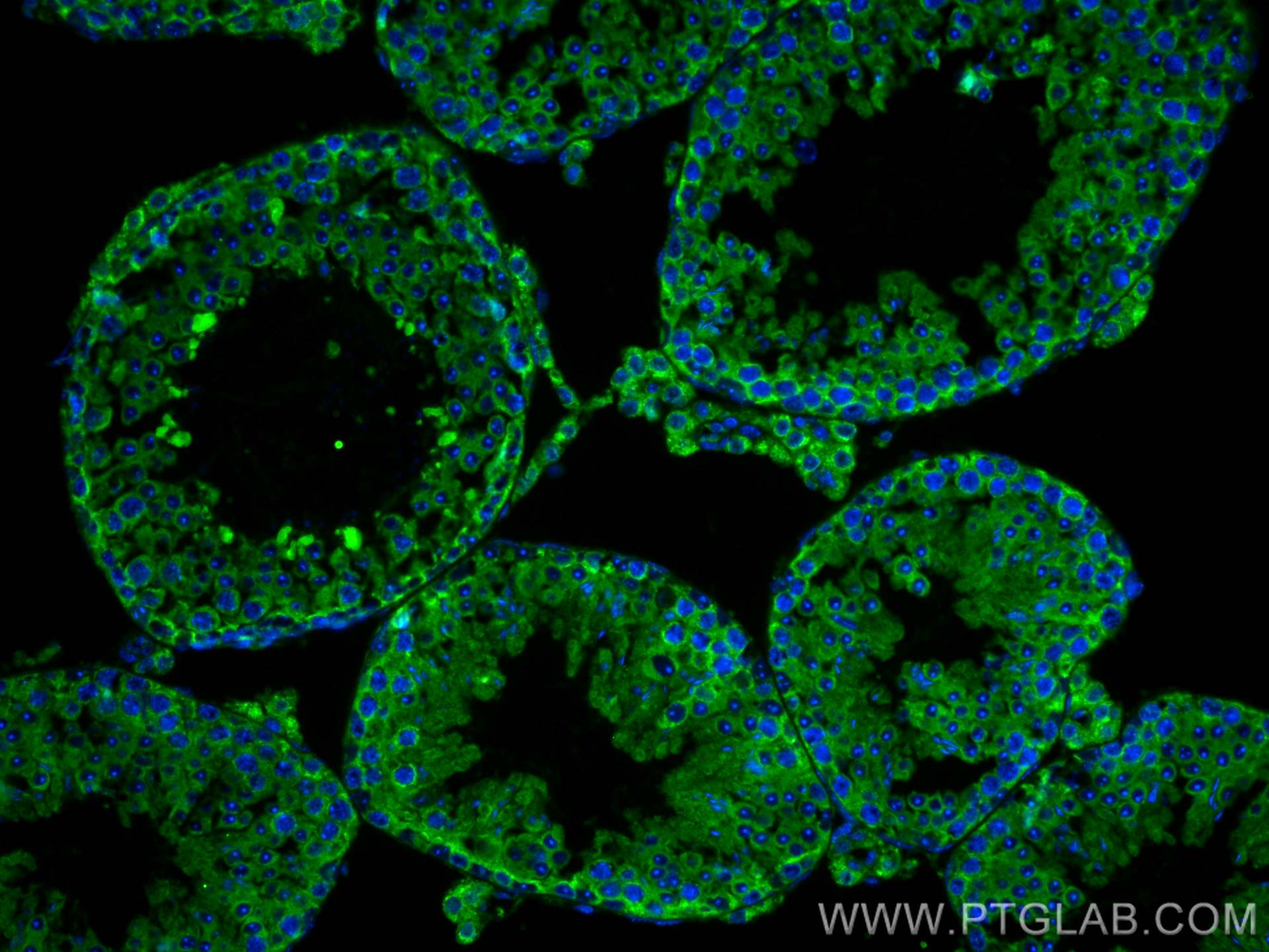 Immunofluorescence (IF) / fluorescent staining of mouse testis tissue using C9orf116 Polyclonal antibody (26576-1-AP)