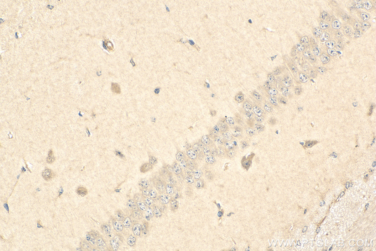 Immunohistochemistry (IHC) staining of mouse brain tissue using C9orf117 Polyclonal antibody (21012-1-AP)