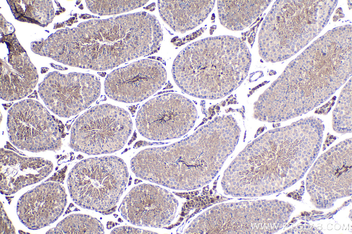 Immunohistochemistry (IHC) staining of mouse testis tissue using NGX6 Polyclonal antibody (21593-1-AP)