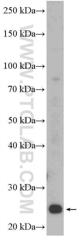 Western Blot (WB) analysis of Jurkat cells using C9orf142 Polyclonal antibody (27134-1-AP)