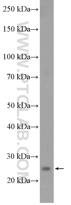 Western Blot (WB) analysis of HeLa cells using C9orf142 Polyclonal antibody (27134-1-AP)