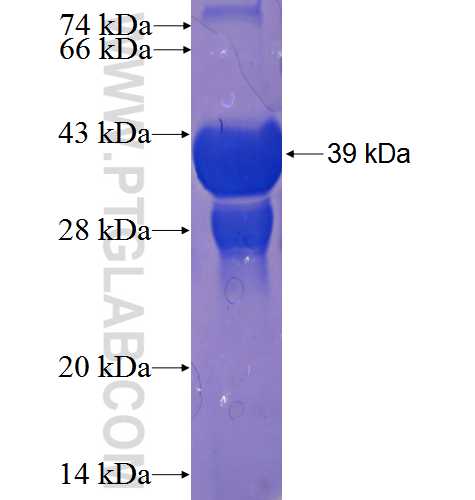 C9orf25 fusion protein Ag23771 SDS-PAGE