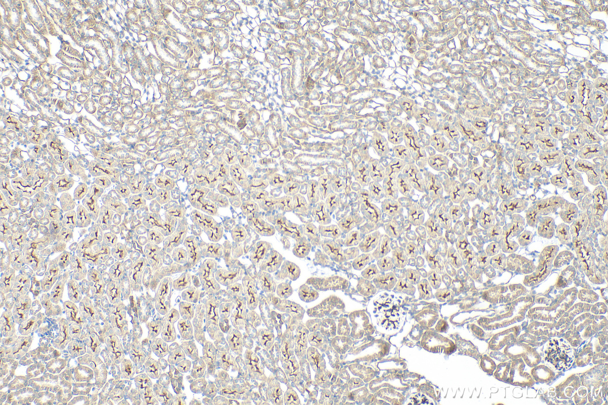 Immunohistochemistry (IHC) staining of mouse kidney tissue using C9orf71 Polyclonal antibody (30509-1-AP)