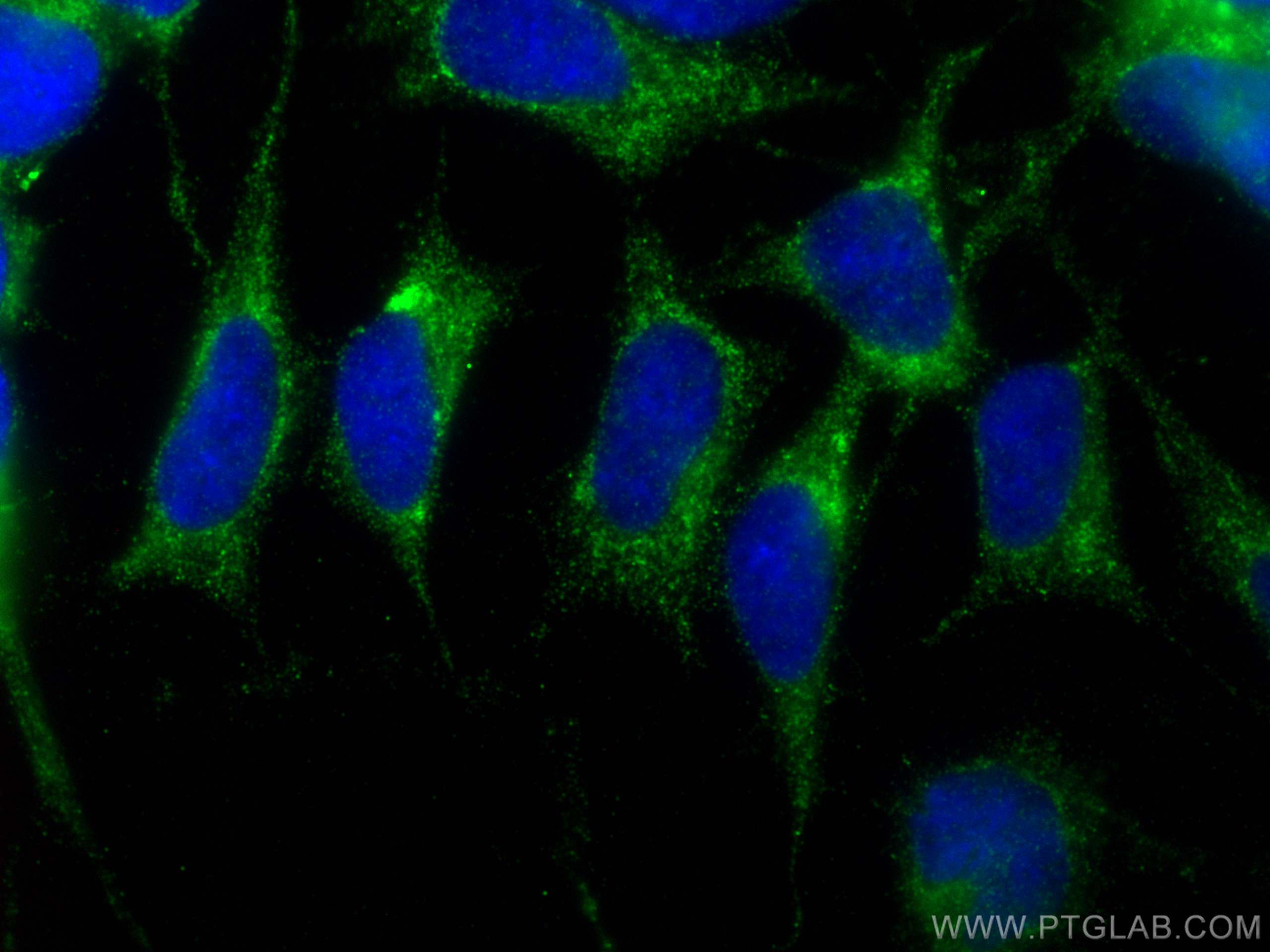 Immunofluorescence (IF) / fluorescent staining of SH-SY5Y cells using C9orf72 Polyclonal antibody (22637-1-AP)