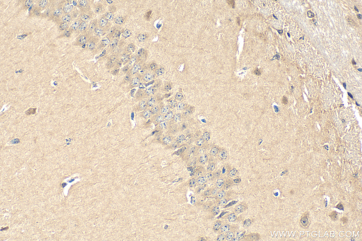 Immunohistochemistry (IHC) staining of mouse brain tissue using C9orf72 Polyclonal antibody (22637-1-AP)