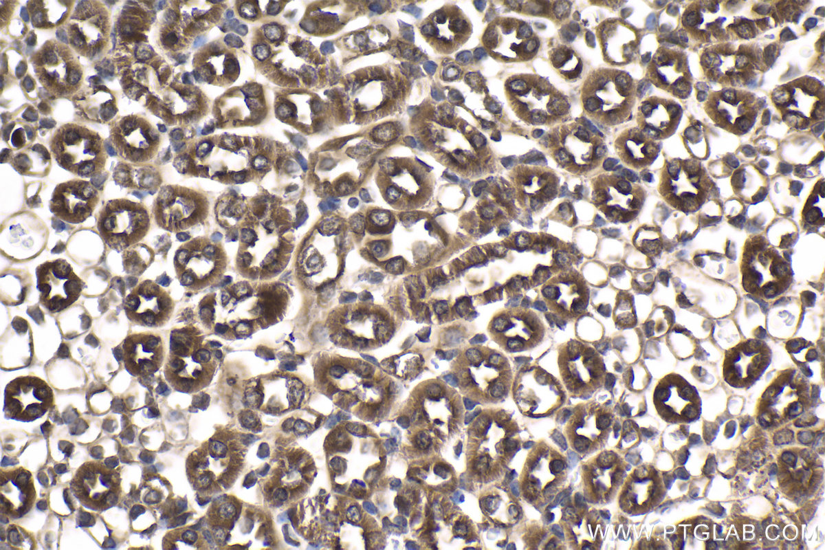 Immunohistochemistry (IHC) staining of mouse kidney tissue using C9orf72 Polyclonal antibody (25757-1-AP)