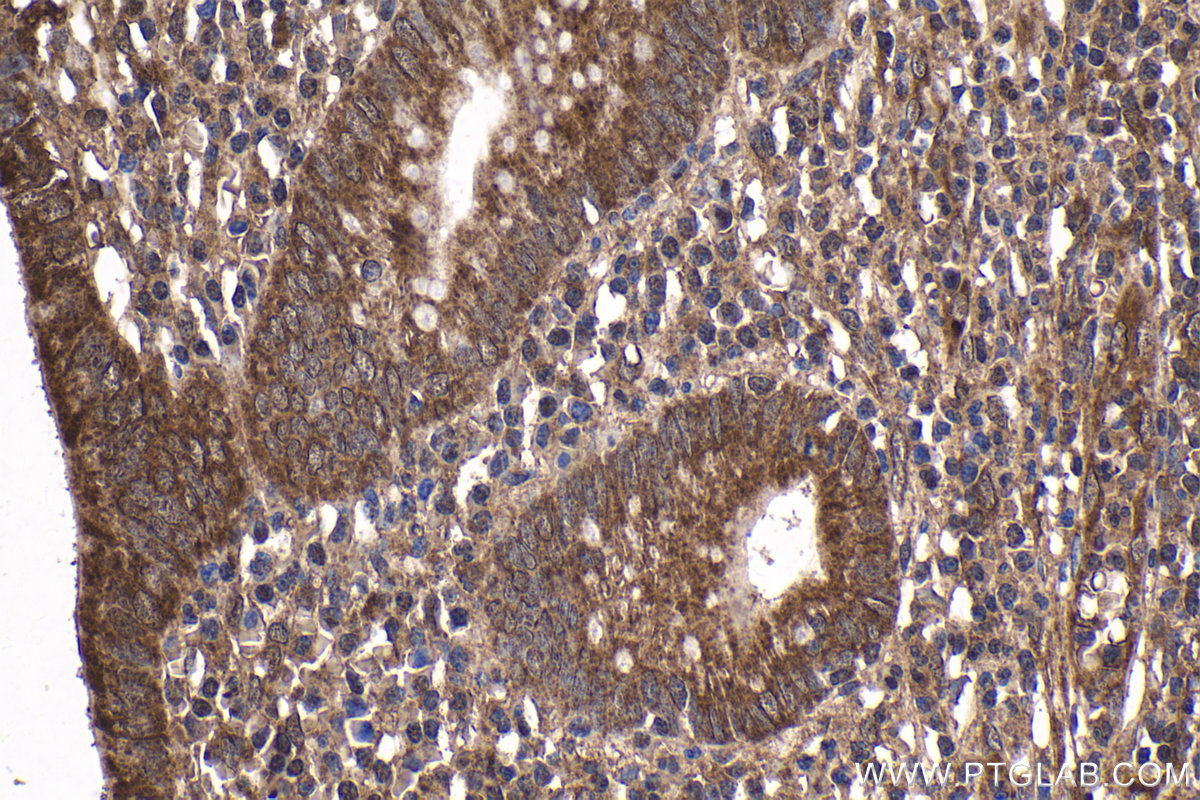 Immunohistochemistry (IHC) staining of human appendicitis tissue using C9orf72 Polyclonal antibody (25757-1-AP)