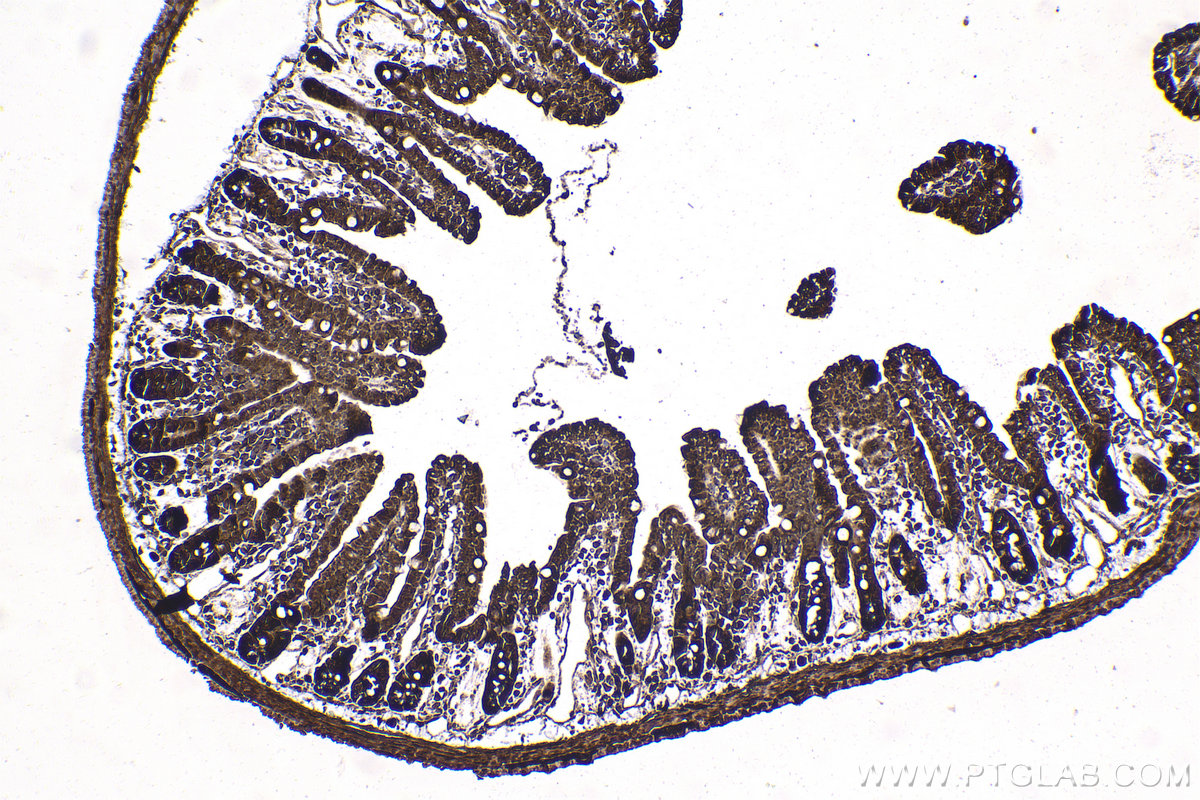 Immunohistochemistry (IHC) staining of mouse small intestine tissue using C9orf72 Polyclonal antibody (25757-1-AP)