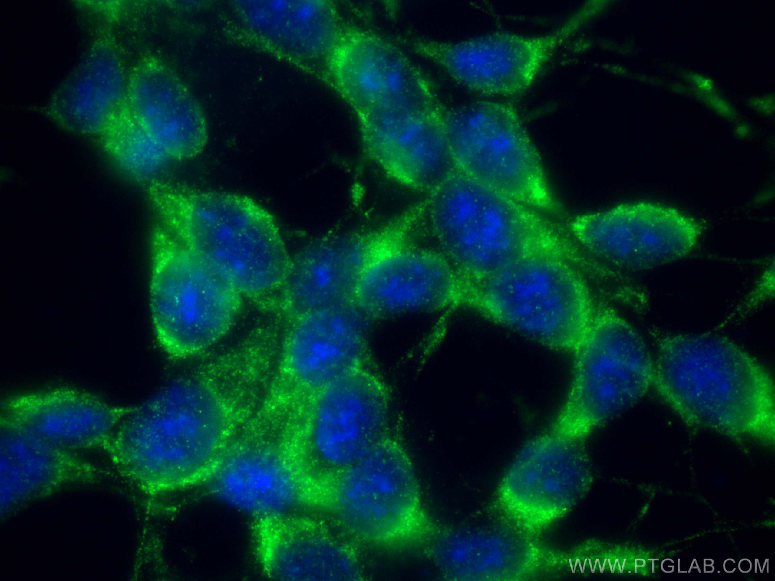 Immunofluorescence (IF) / fluorescent staining of SH-SY5Y cells using C9orf72 Monoclonal antibody (66140-1-Ig)