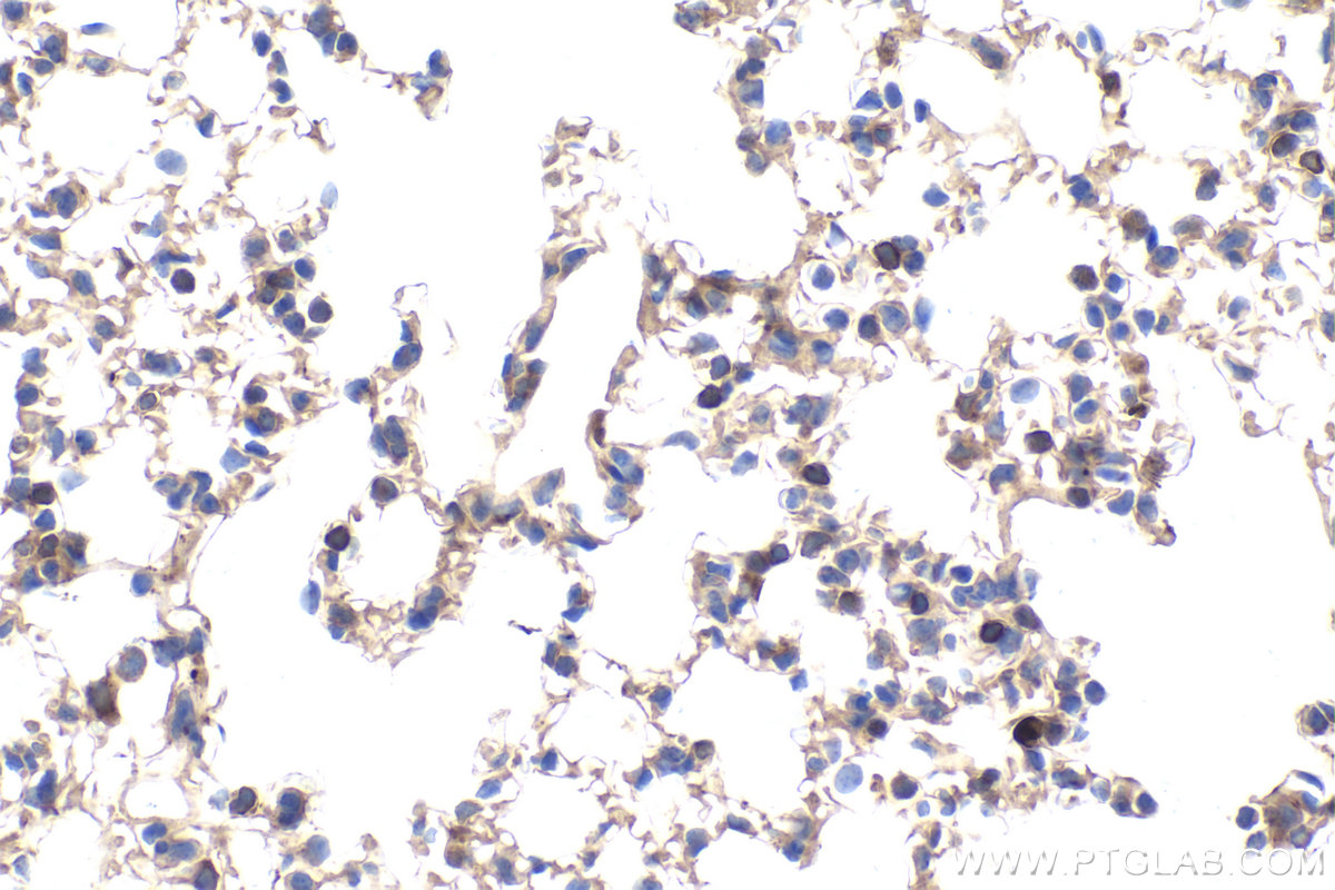 Immunohistochemistry (IHC) staining of mouse lung tissue using C9orf72 Monoclonal antibody (67824-1-Ig)