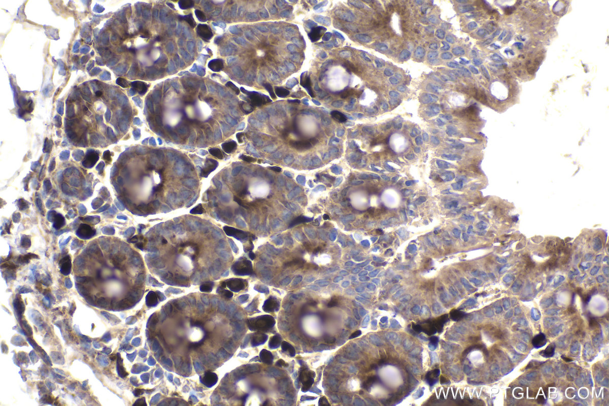 Immunohistochemistry (IHC) staining of mouse intestine using C9orf72 Monoclonal antibody (67824-1-Ig)