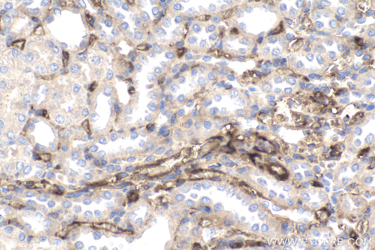 Immunohistochemistry (IHC) staining of rat kidney tissue using C9orf72 Monoclonal antibody (67824-1-Ig)