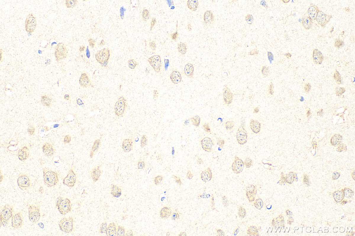 Immunohistochemistry (IHC) staining of mouse brain tissue using C9orf80 Polyclonal antibody (26127-1-AP)