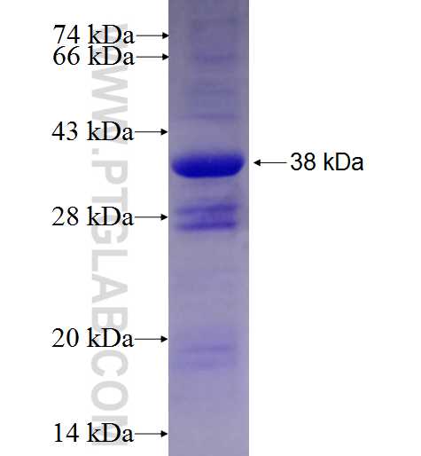 C9orf91 fusion protein Ag26867 SDS-PAGE