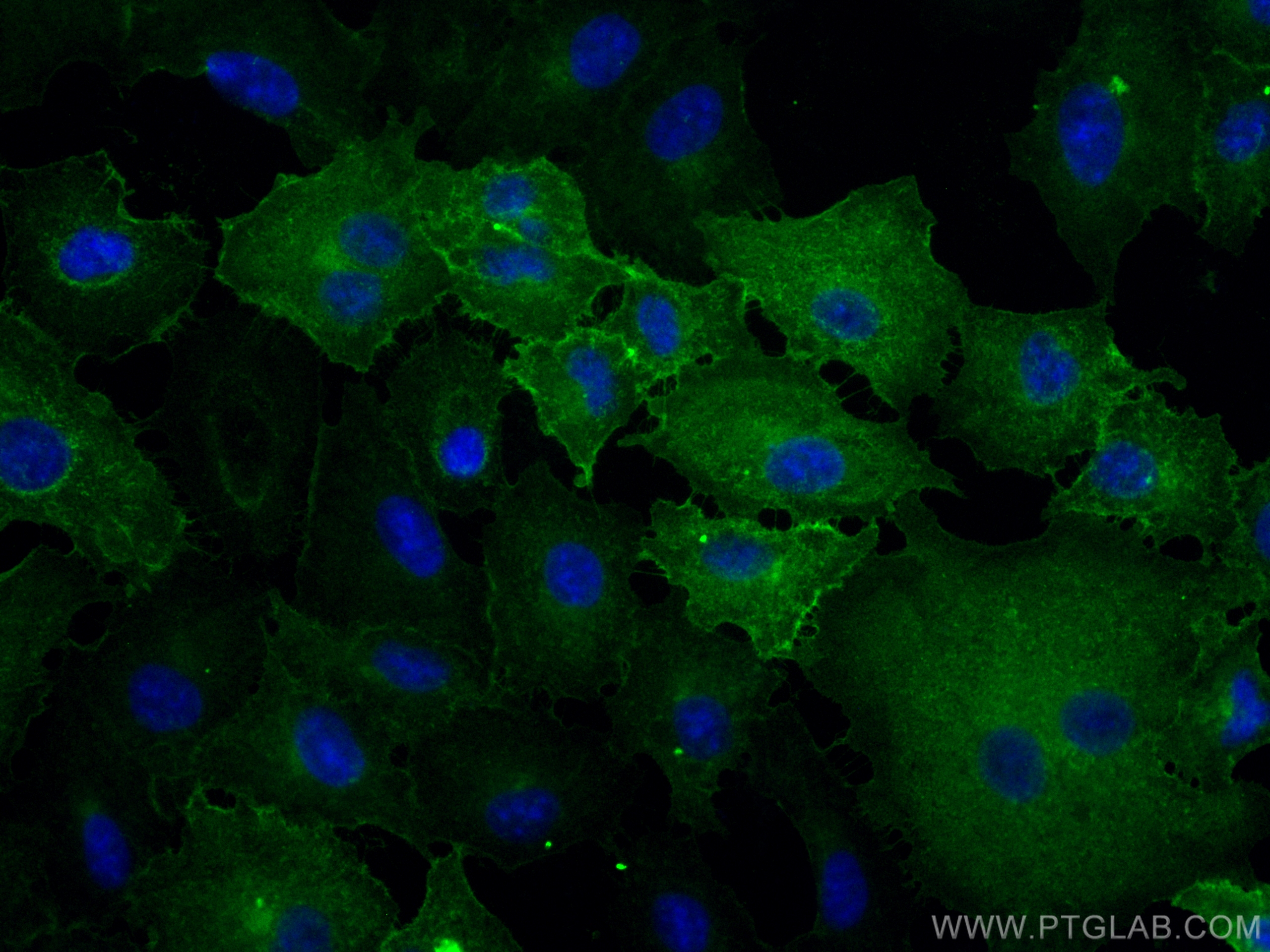 Immunofluorescence (IF) / fluorescent staining of A549 cells using CoraLite® Plus 488-conjugated CA12 Monoclonal anti (CL488-68224)