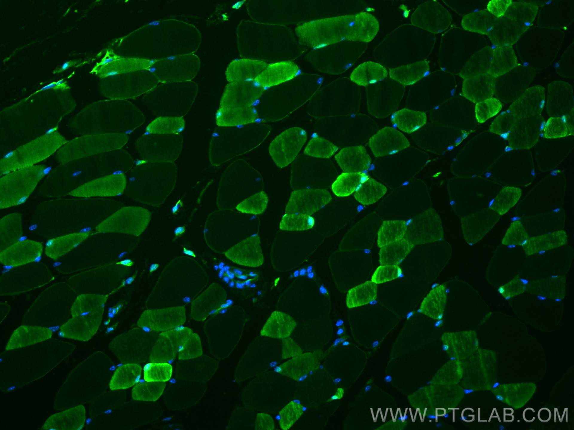 Immunofluorescence (IF) / fluorescent staining of mouse skeletal muscle tissue using CoraLite® Plus 488-conjugated CA3 Polyclonal antib (CL488-15197)