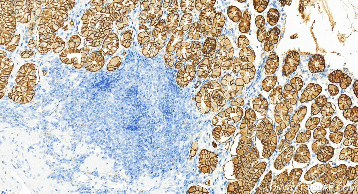 Immunohistochemistry (IHC) staining of normal stomach using CA9 Polyclonal antibody (11071-1-AP)