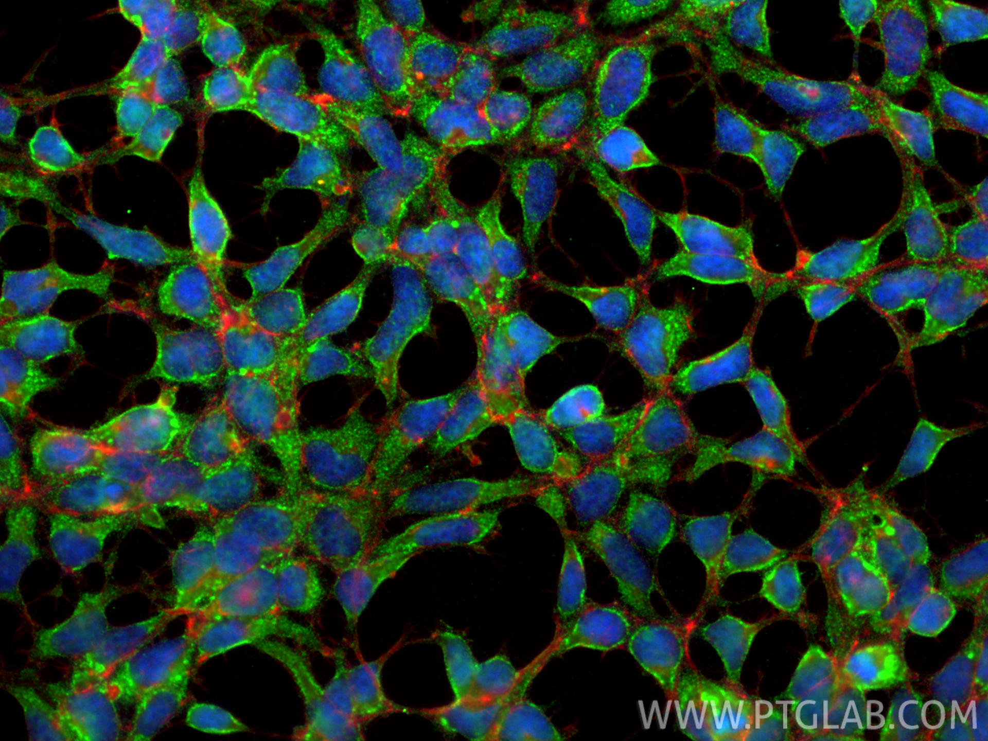 Immunofluorescence (IF) / fluorescent staining of HEK-293 cells using Carbonic Anhydrase IX/CA9 Polyclonal antibody (11071-1-AP)