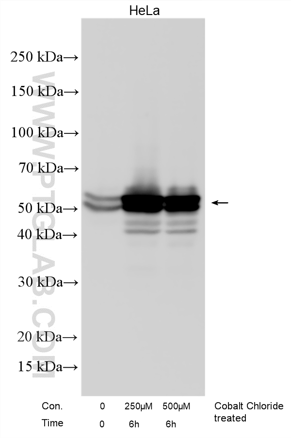 Western Blot (WB) analysis of various lysates using Carbonic Anhydrase IX/CA9 Polyclonal antibody (11071-1-AP)