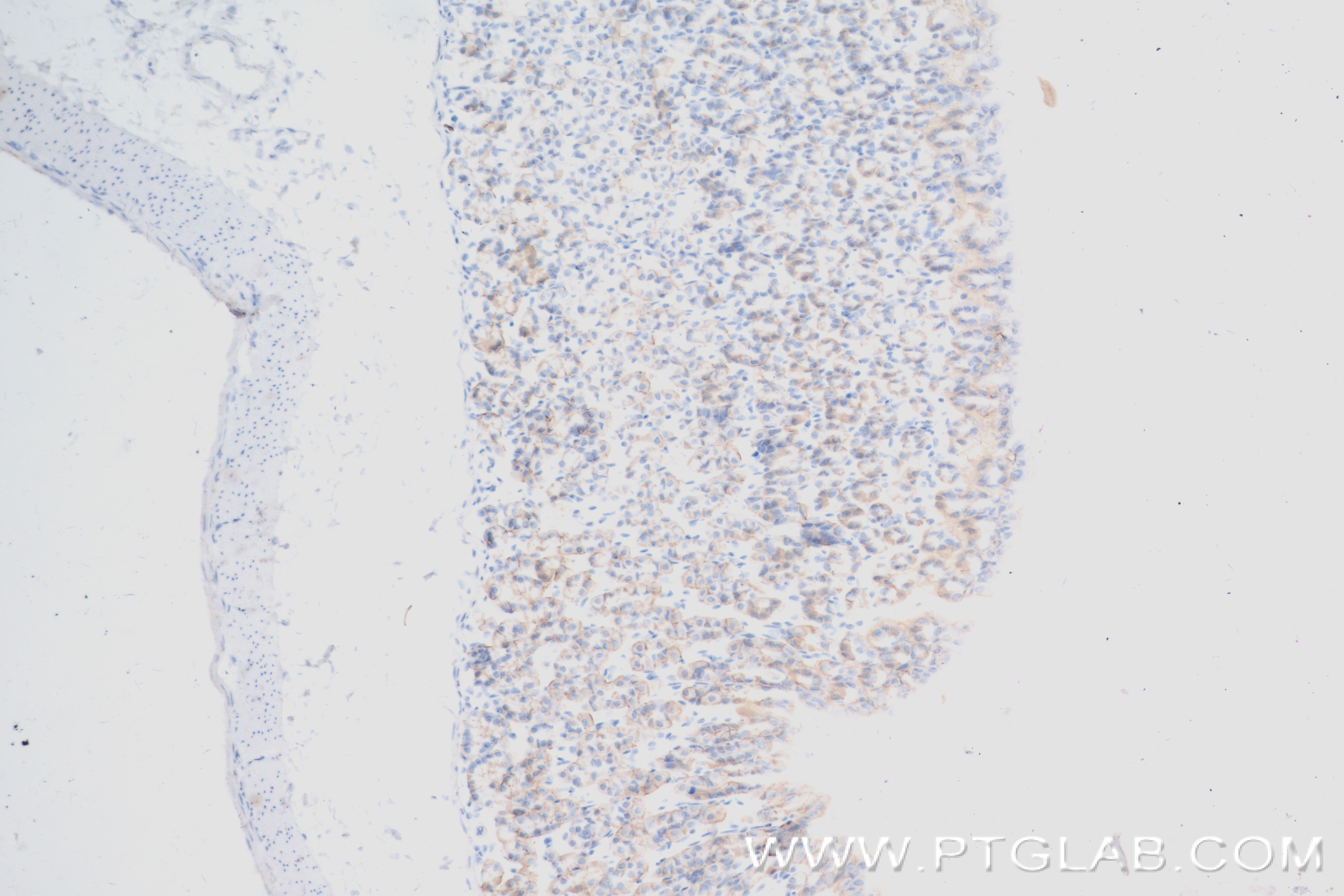 Immunohistochemistry (IHC) staining of mouse stomach tissue using CA9 Recombinant antibody (84233-1-RR)