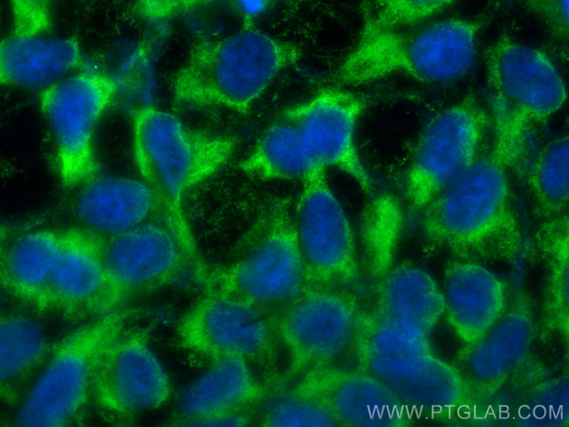 Immunofluorescence (IF) / fluorescent staining of HEK-293 cells using CAB39L Polyclonal antibody (16137-1-AP)