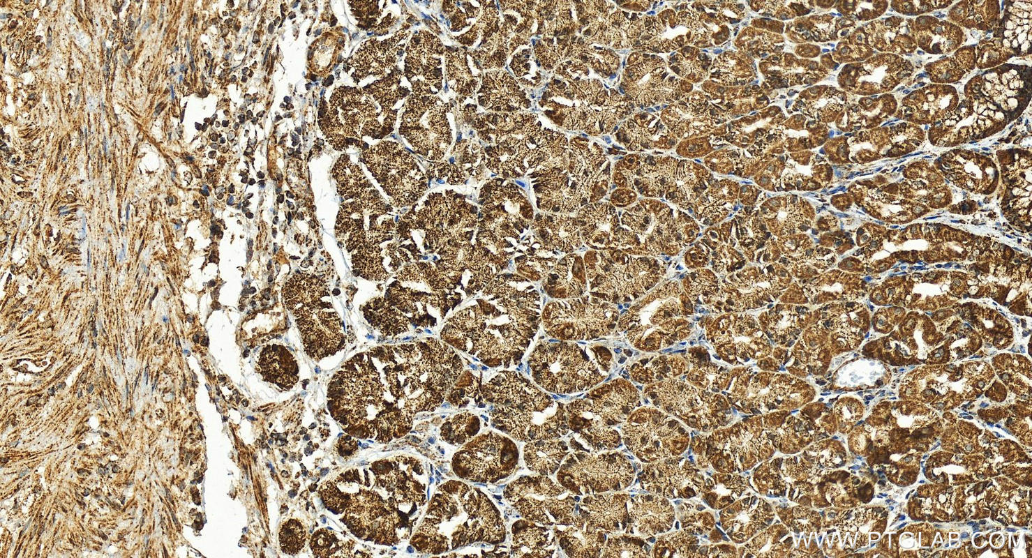 Immunohistochemistry (IHC) staining of human stomach tissue using CABC1 Polyclonal antibody (15528-1-AP)