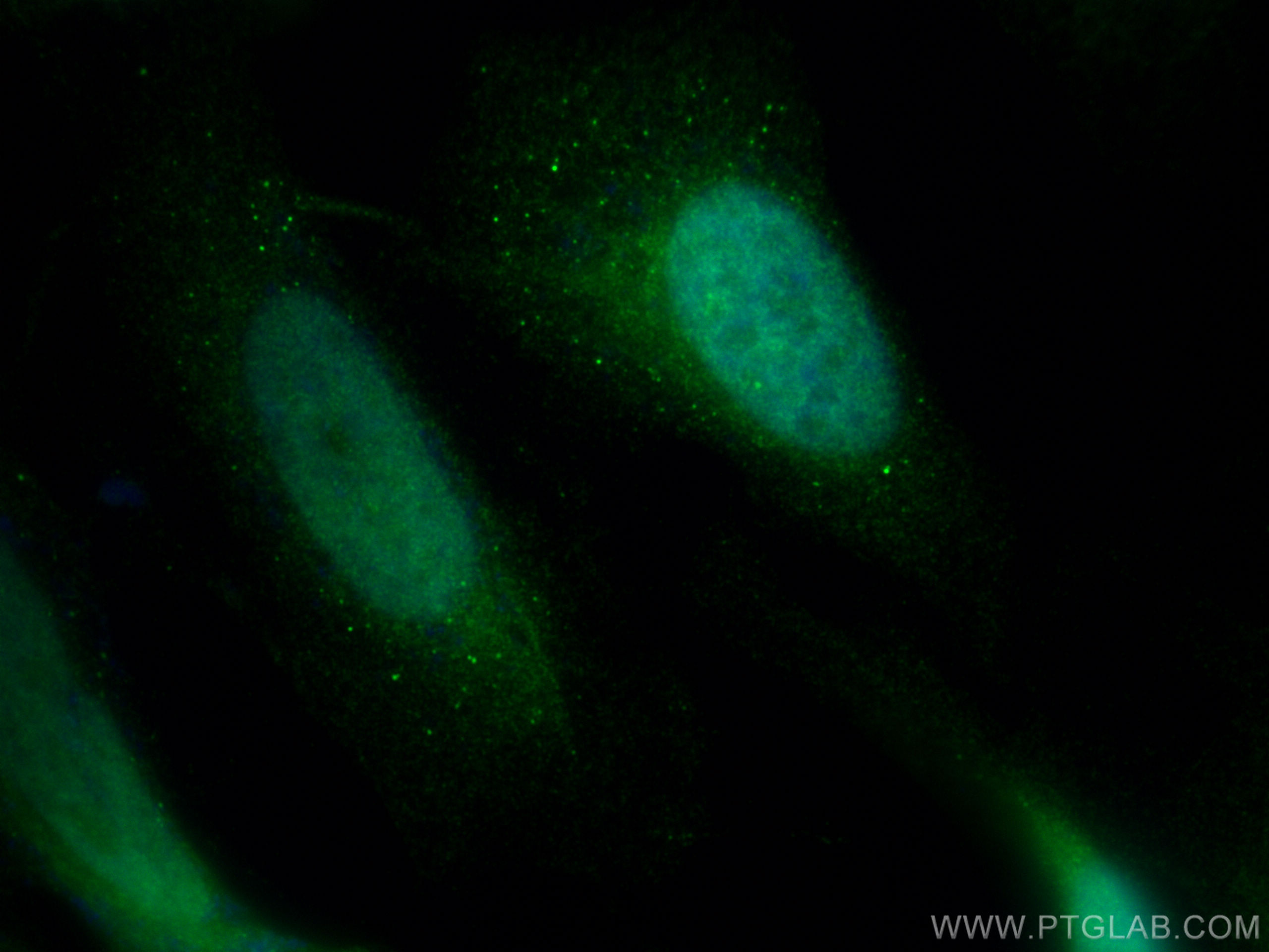 Immunofluorescence (IF) / fluorescent staining of HeLa cells using CABLES1 Polyclonal antibody (13464-1-AP)