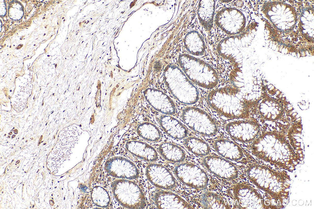 Immunohistochemistry (IHC) staining of human colon tissue using CABLES1 Polyclonal antibody (13464-1-AP)