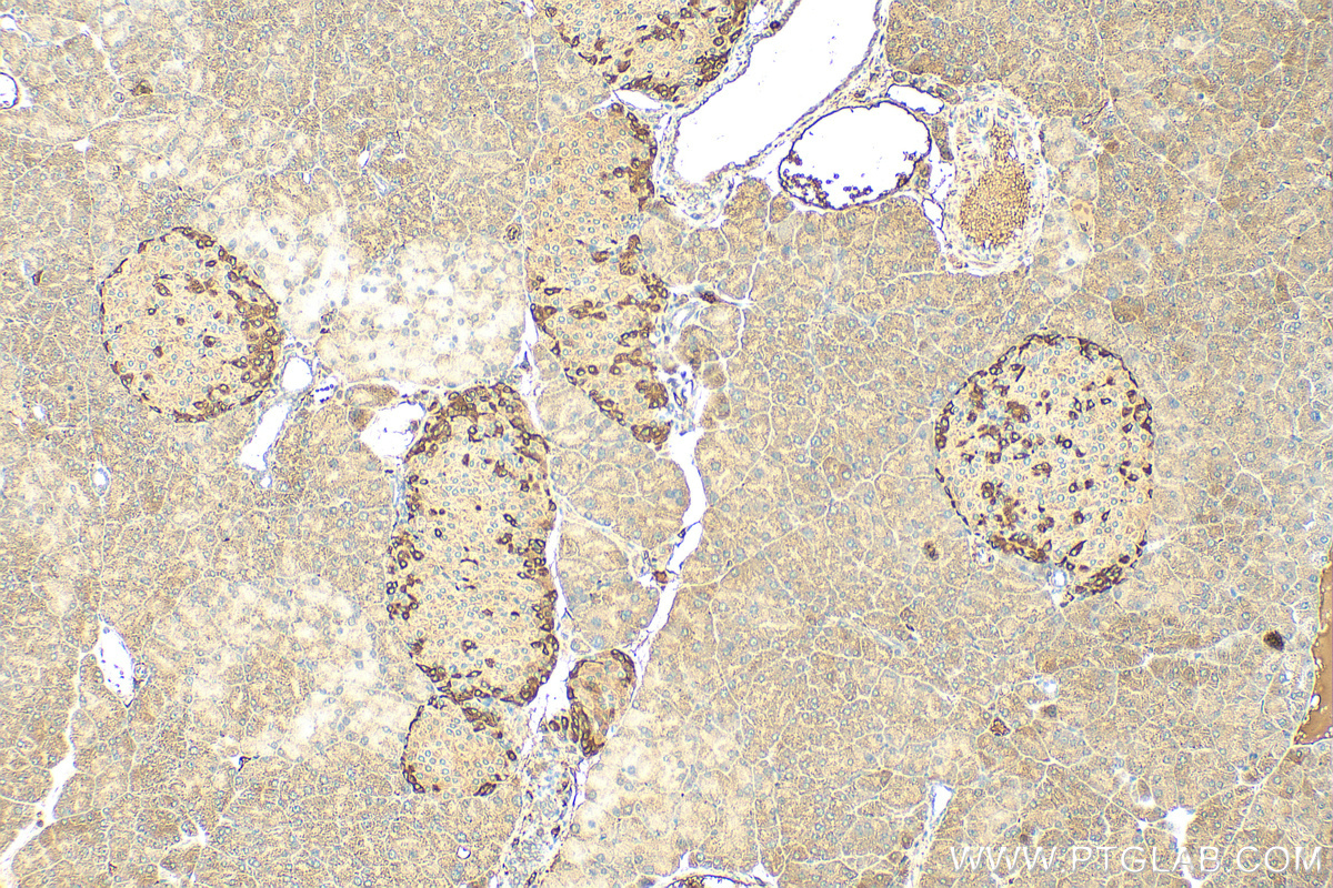 Immunohistochemistry (IHC) staining of mouse pancreas tissue using CABLES1 Polyclonal antibody (13464-1-AP)