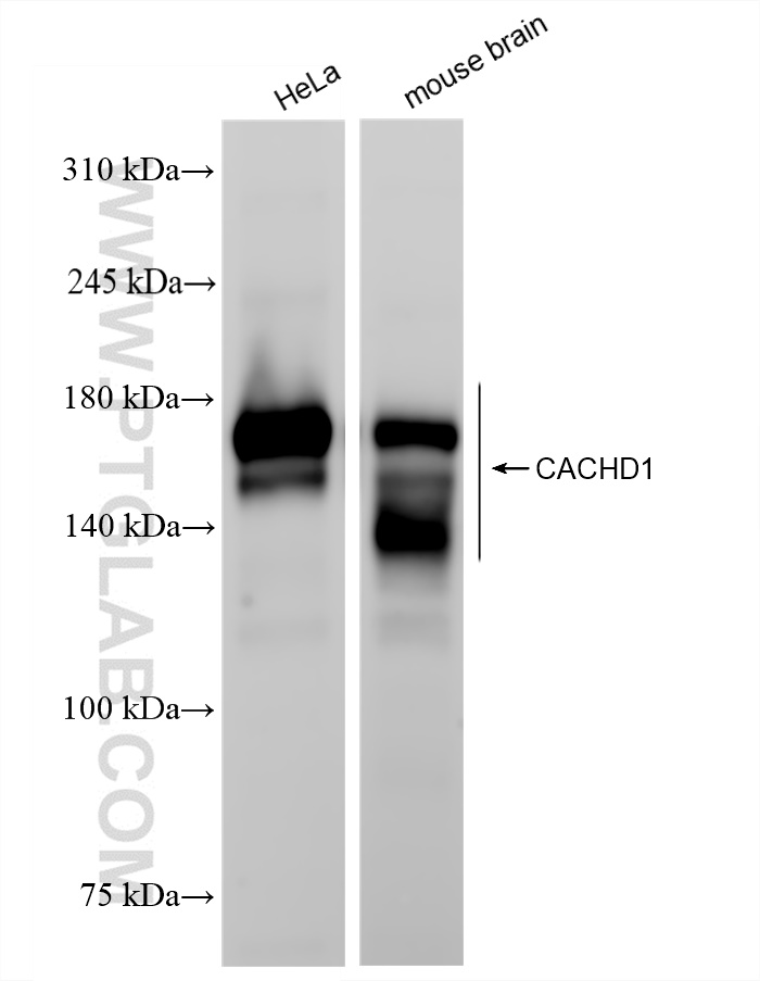 Western Blot (WB) analysis of various lysates using CACHD1 Recombinant antibody (83350-4-RR)