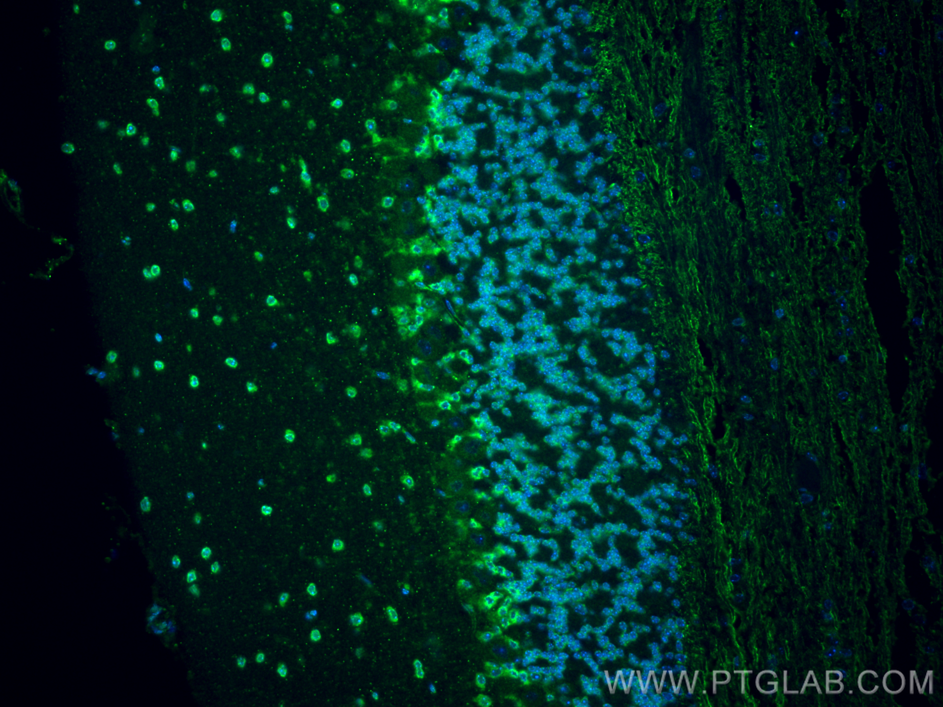 Immunofluorescence (IF) / fluorescent staining of mouse cerebellum tissue using CACNA1B Polyclonal antibody (30625-1-AP)