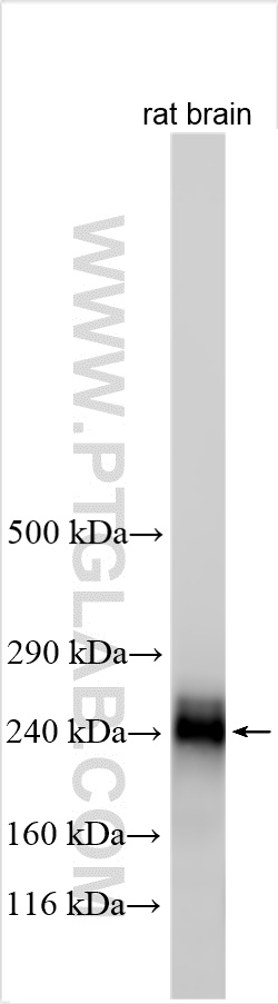 Western Blot (WB) analysis of various lysates using CACNA1E Polyclonal antibody (27225-1-AP)