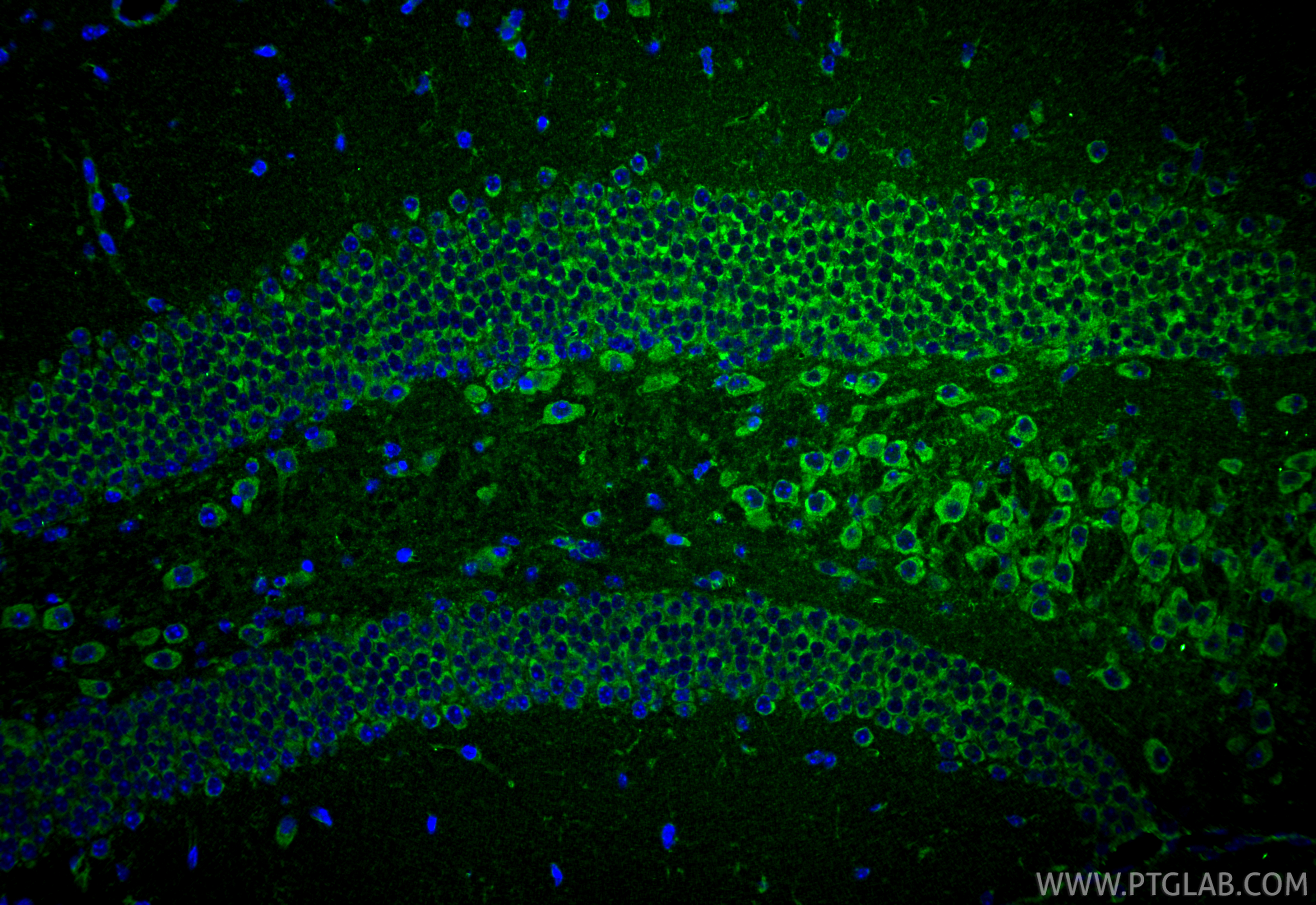 Immunofluorescence (IF) / fluorescent staining of mouse brain tissue using CACNA1G Polyclonal antibody (17821-1-AP)