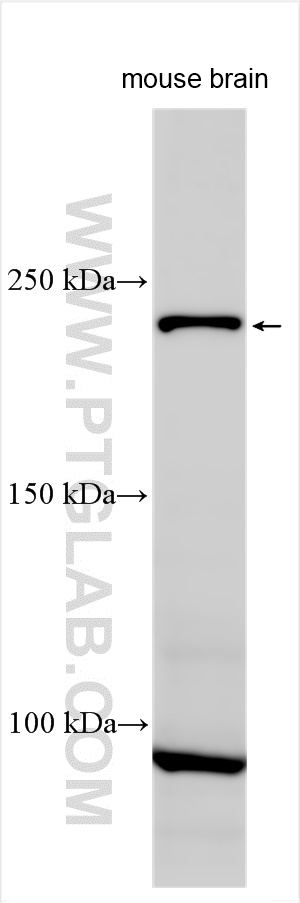 Western Blot (WB) analysis of various lysates using CACNA1I-Specific Polyclonal antibody (19534-1-AP)