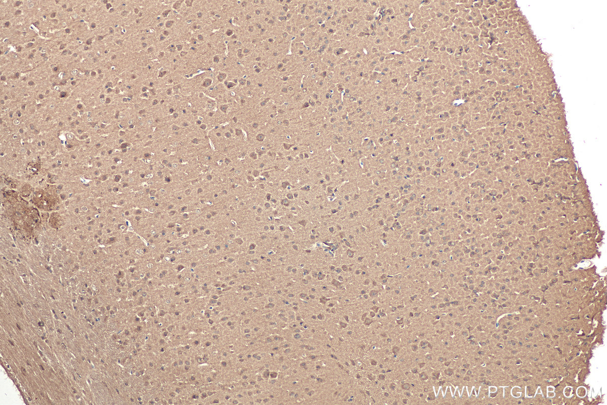 Immunohistochemistry (IHC) staining of mouse brain tissue using CACYBP Monoclonal antibody (68161-1-Ig)