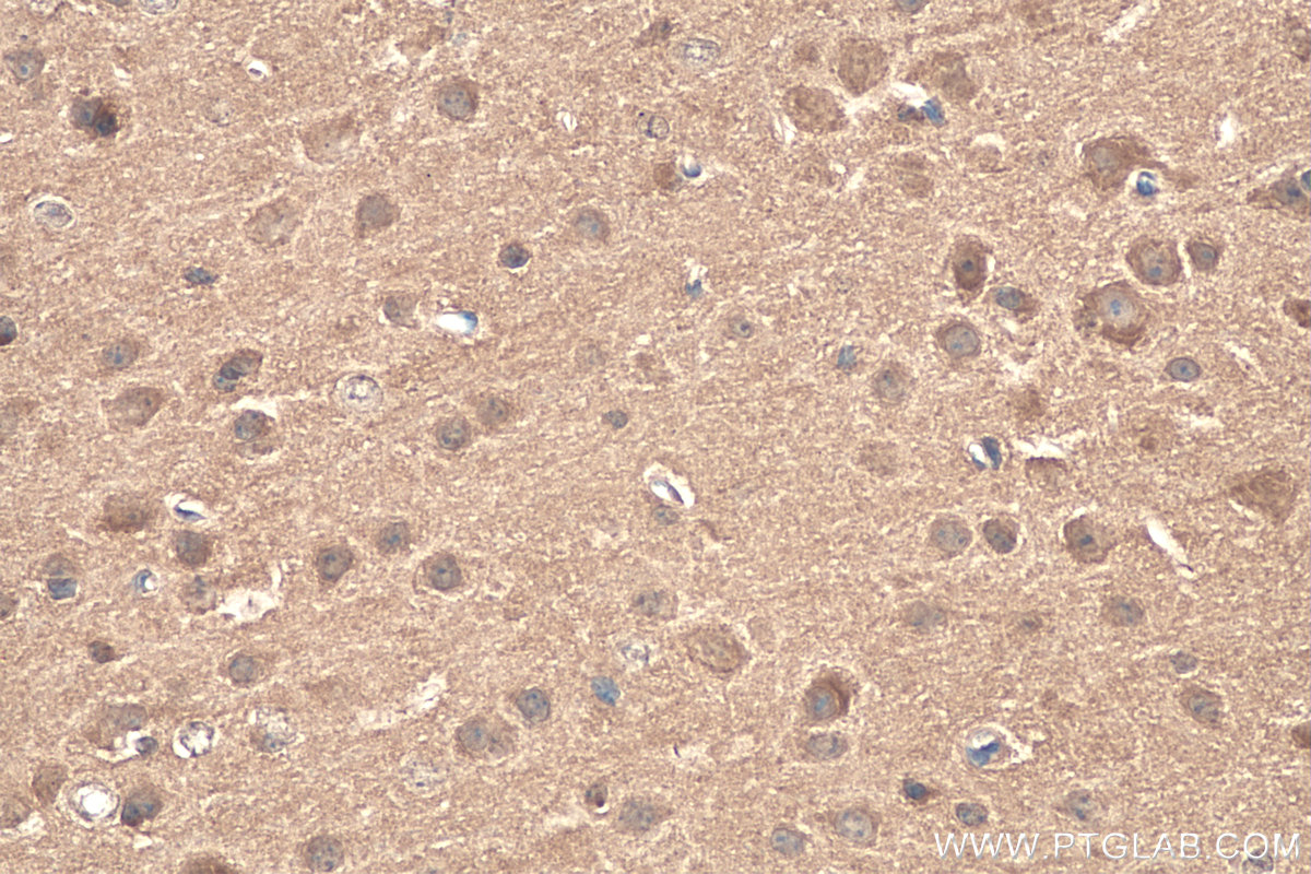 Immunohistochemistry (IHC) staining of mouse brain tissue using CACYBP Monoclonal antibody (68161-1-Ig)