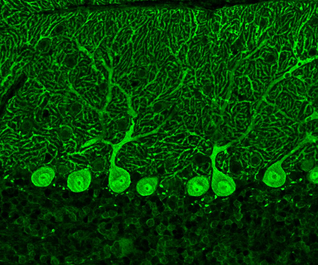 Immunofluorescence (IF) / fluorescent staining of mouse cerebellum tissue using Calbindin-D28k Polyclonal antibody (14479-1-AP)