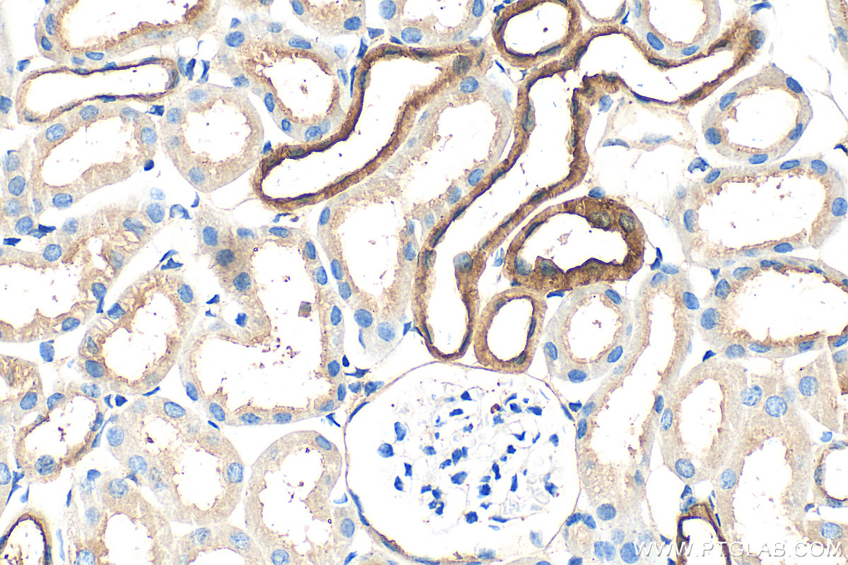 Immunohistochemistry (IHC) staining of mouse kidney tissue using Calbindin-D28k Polyclonal antibody (14479-1-AP)