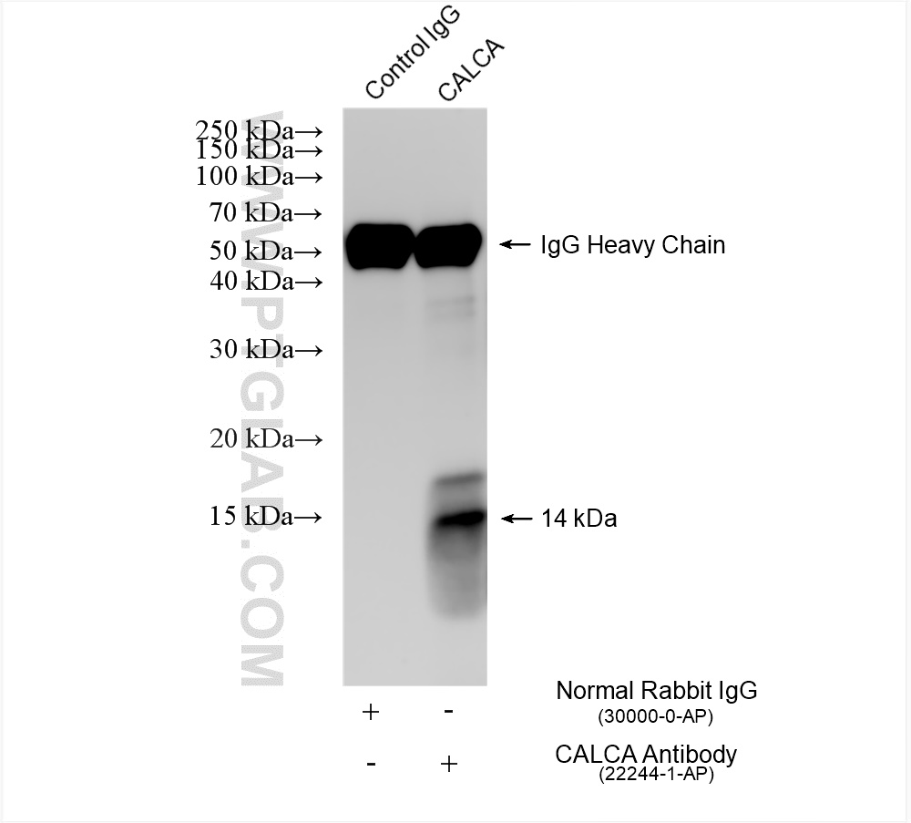 Immunoprecipitation (IP) experiment of TT cells using CALCA/CGRP Polyclonal antibody (22244-1-AP)